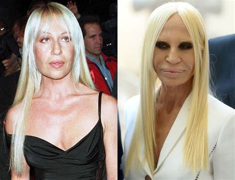 donatella versace before plastic.